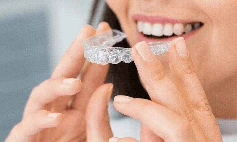 How Invisalign Pricing in Singapore Has Changed Over the Last Few Years