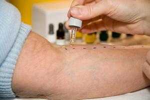 Food Allergy Test